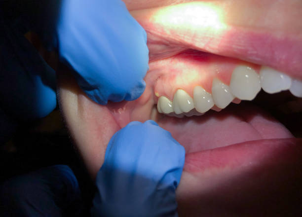Best Emergency Dentist Near Me  in Barrington, NJ