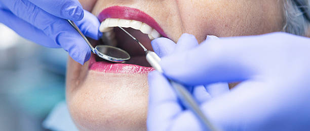 Best Chipped Tooth Repair Near Me  in Barrington, NJ